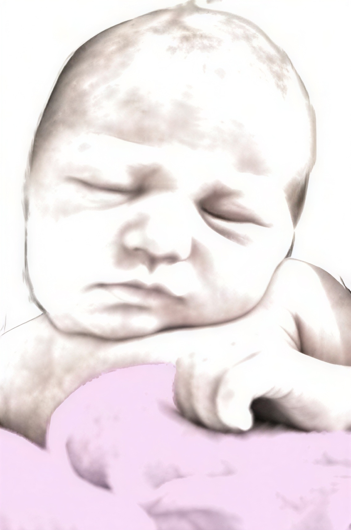 Infant with torticollis illustration